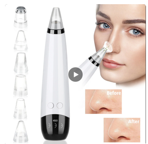 Blackhead Remover Vacuum Acne Pimple Black Spot Suction Electric Facial Pore Cleaner Skincare Exfoliating Beauty Device (rechargable).